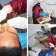 Komitmen Lapas Banjarmasin Tingkatkan Pelayanan Kesehatan Warga Binaan Lapas Banjarmasin