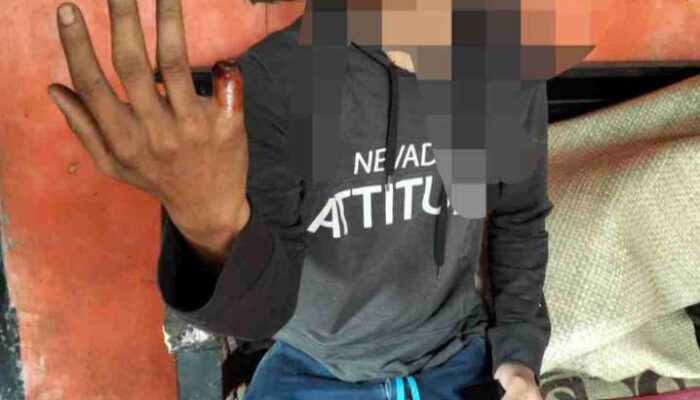 Pekerja Alami Cacat Permanen, PT Solusindo Bersama Mulya Diduga Langgar Aturan Ketenagakerjaan